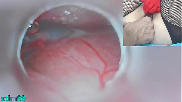 Japanese Insemination with Cum into Uterus and Endoscope Camera by Cervix to watch inside womb Uncensored